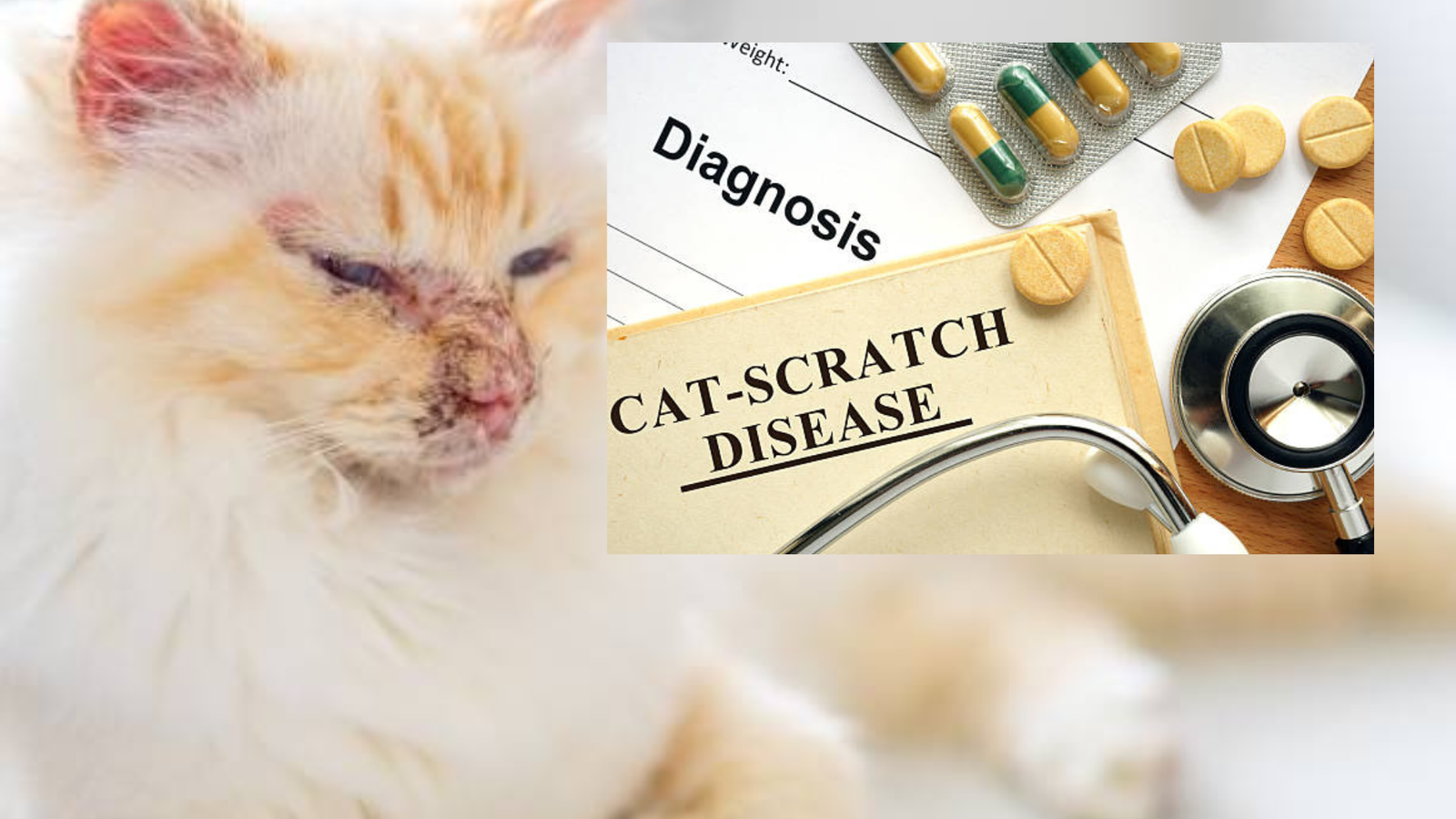 Cat Scratch Disease | What is Cat Scratch Disease?